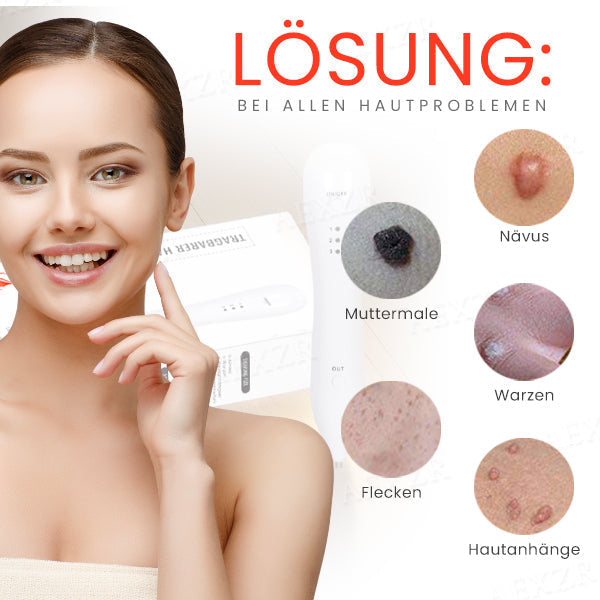 1+1 GRATIS | LuminSkin™ Verabschieden Sie sich von Hautunreinheiten