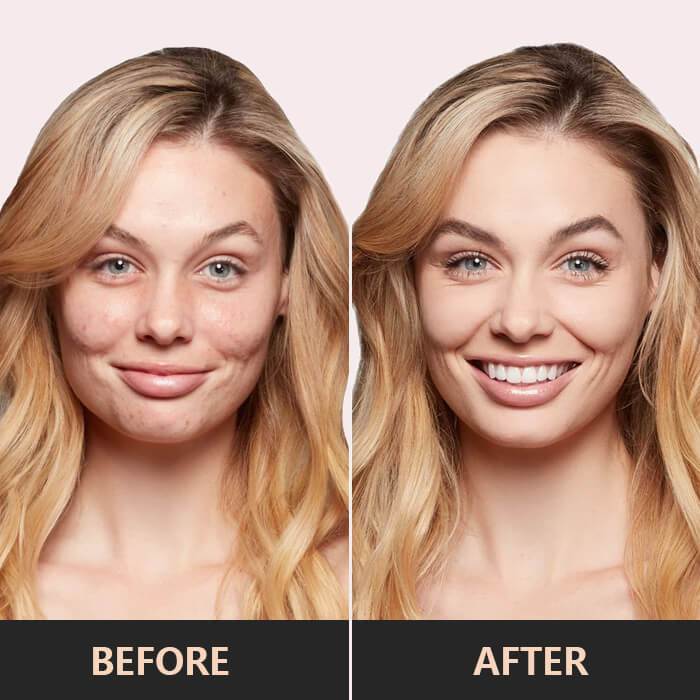 SkinBlend™ – Jugendliche Ausstrahlung