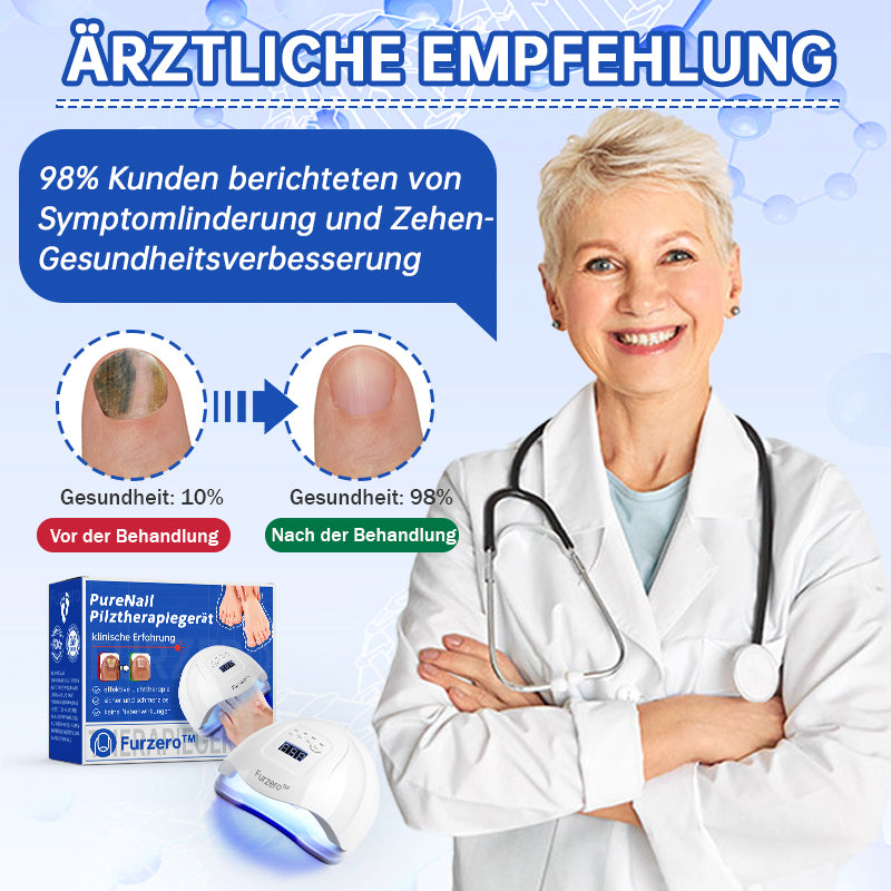 PureNail™ | Pilz-Lasertherapiegerät - Ihre Geheimwaffe gegen Nagelpilz