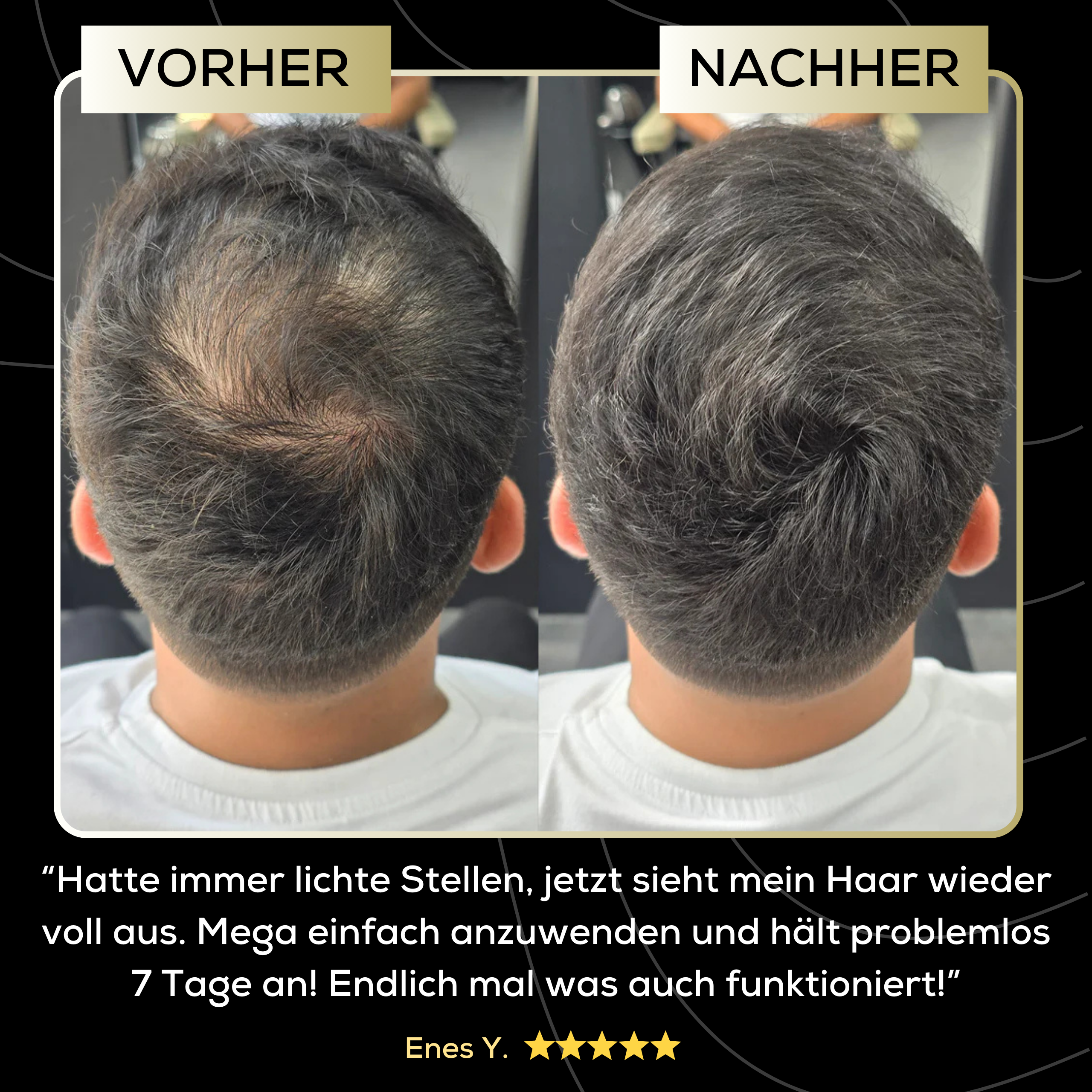 ScalpBlend™ – Unsichtbare Kopfhautfarbe
