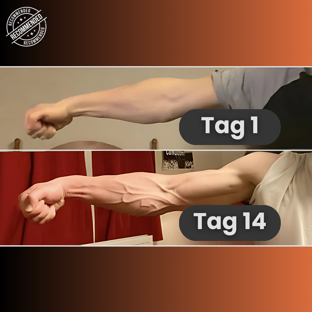 ArmStrong™ – verbessert die Griffkraft