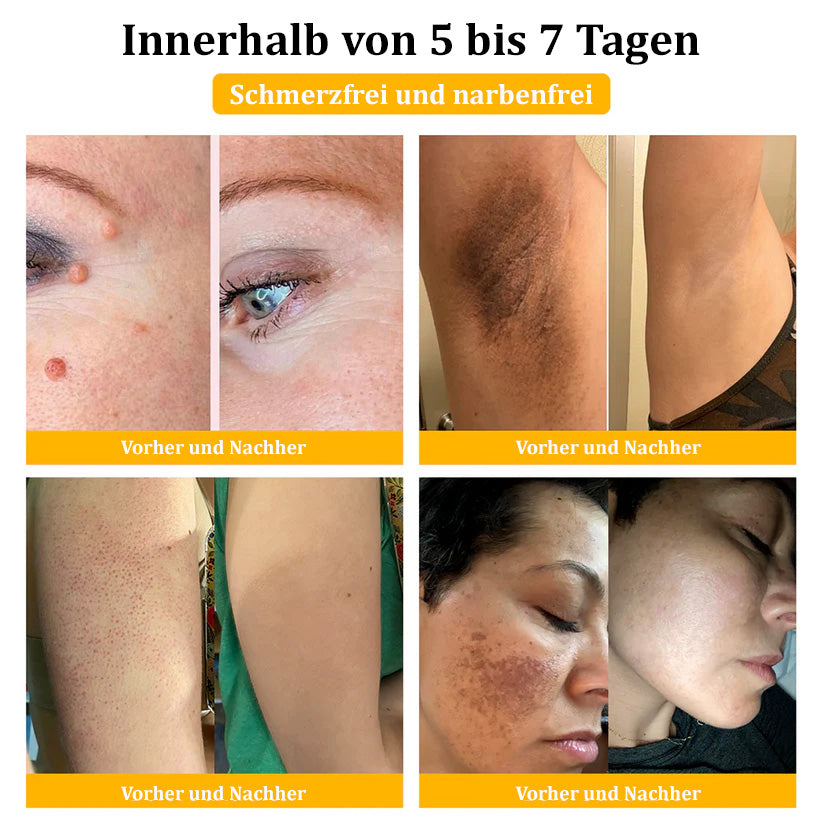 1+1 GRATIS | Turonu™ - Bienengift-Multitherapie-Creme