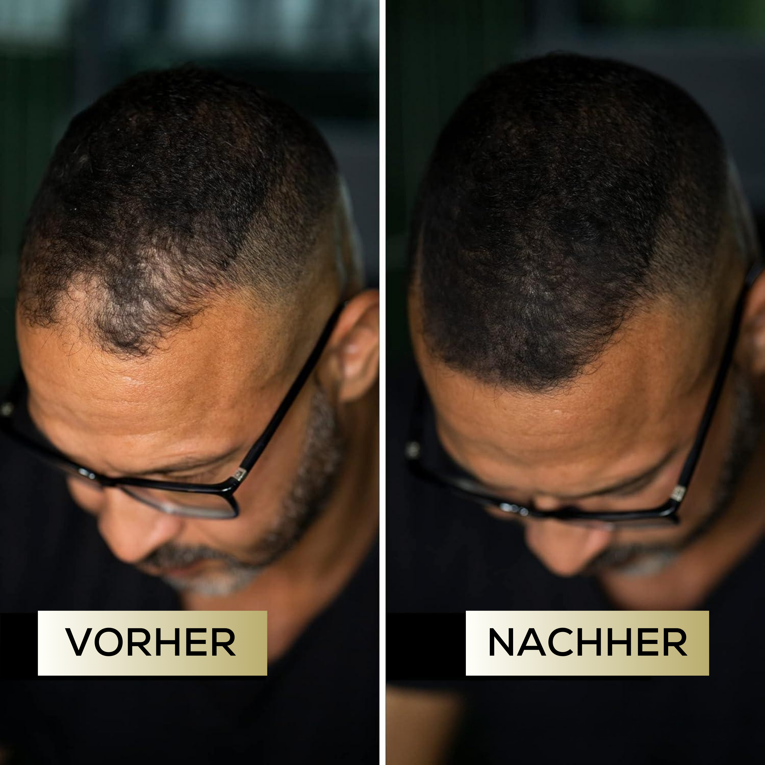 ScalpBlend™ – Unsichtbare Kopfhautfarbe