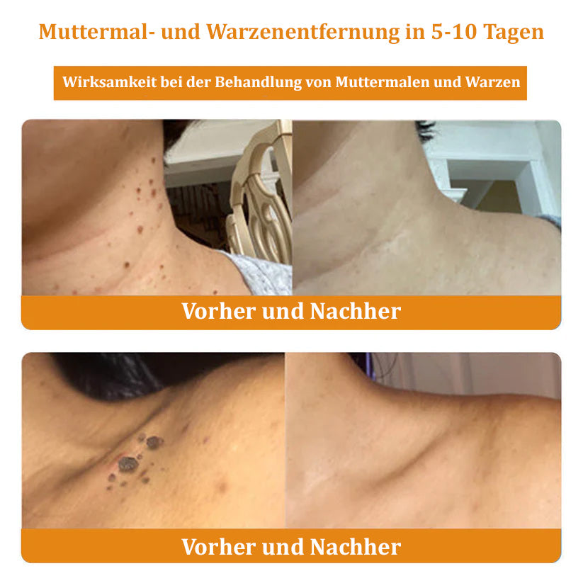 1+1 GRATIS | Turonu™ - Bienengift-Multitherapie-Creme