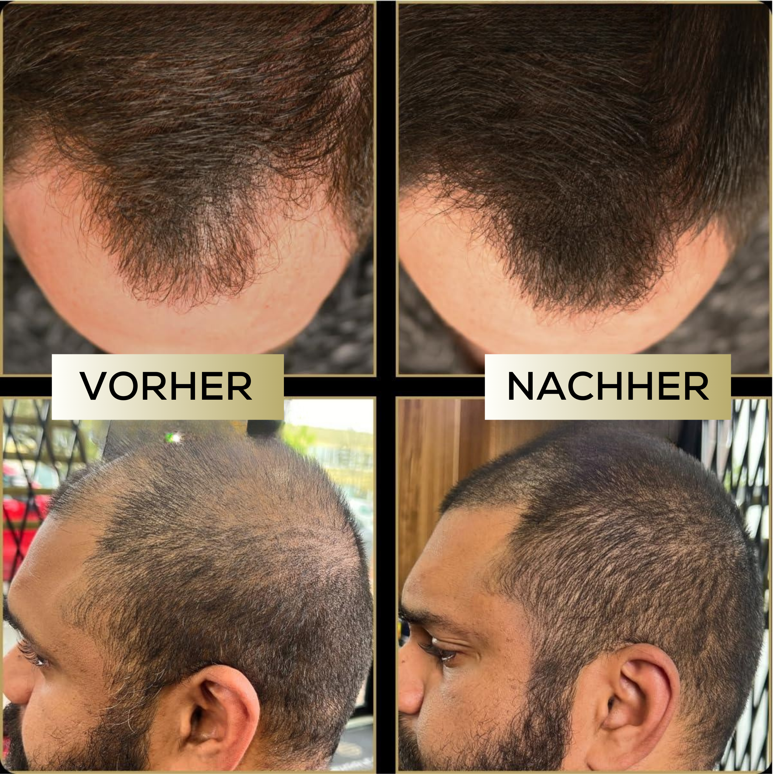 ScalpBlend™ – Unsichtbare Kopfhautfarbe