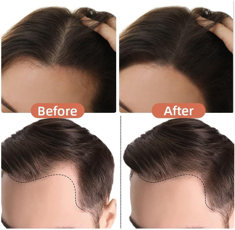 1+1 GRATIS | RootCover™ - Kaschieren Sie mühelos Haarwurzeln und graues Haar in Sekundenschnelle!