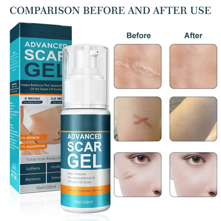 1+1 GRATIS | ScarErase™ Narben schön verblassen lassen