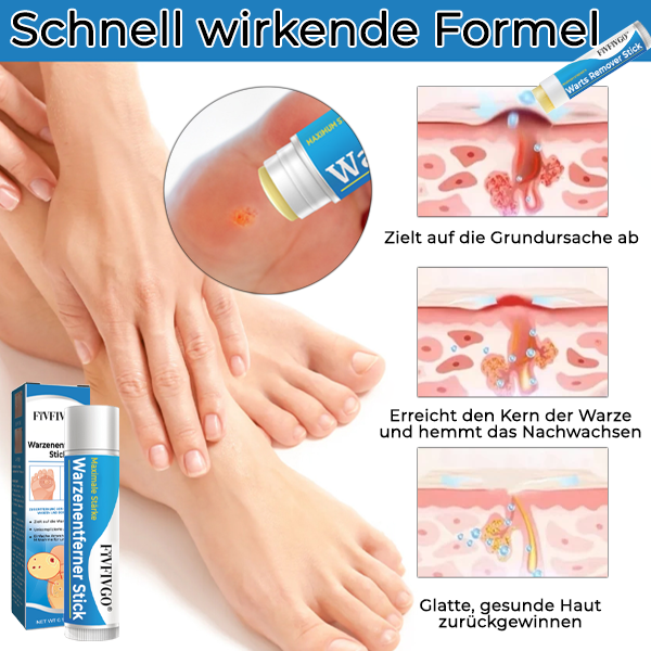 1+1 GRATIS | DermaCare™ Schnelle Warzenentfernung