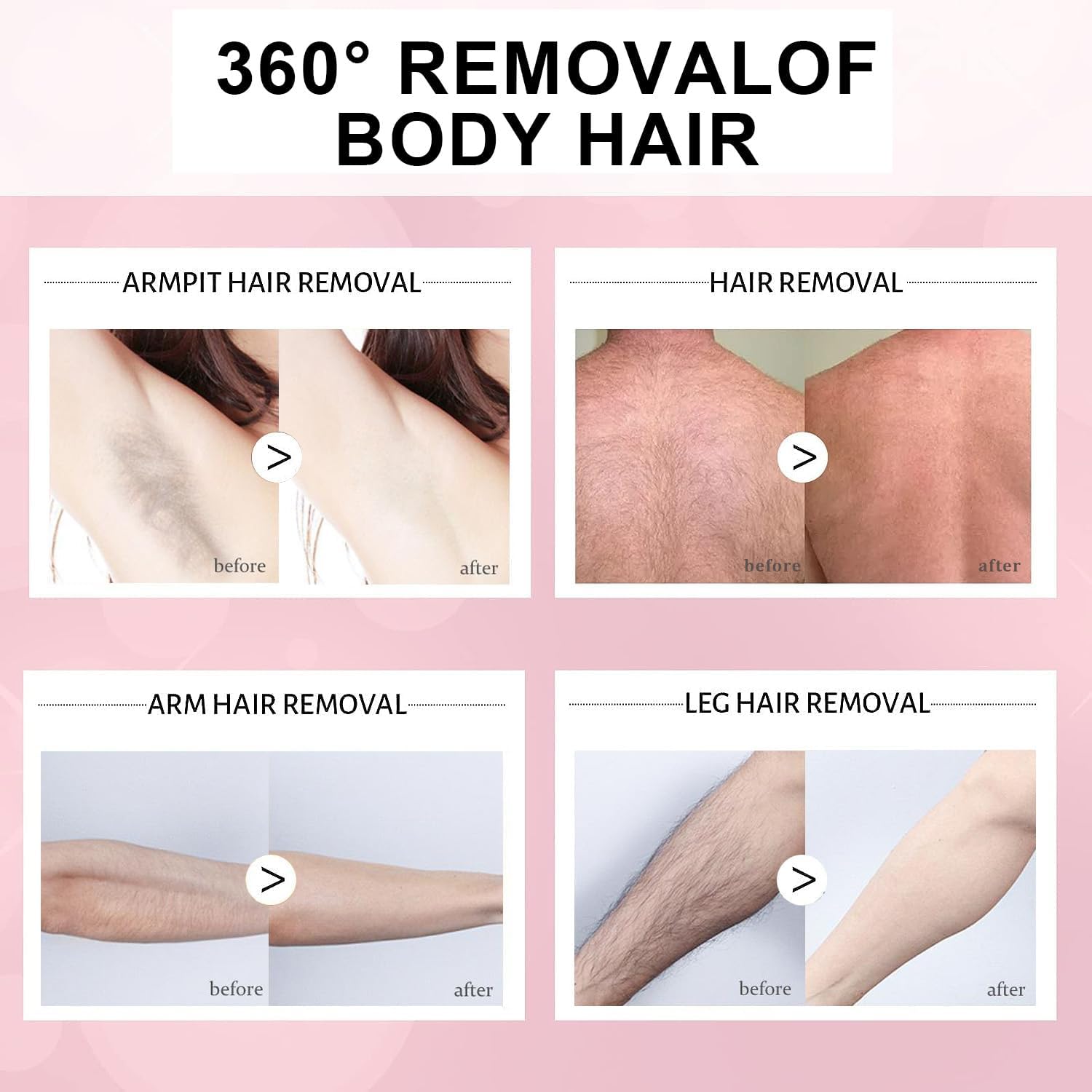 1+1 GRATIS | Honig Mousse™ - Seidenglatte Haut leicht gemacht mit sanfter Haarentfernung!