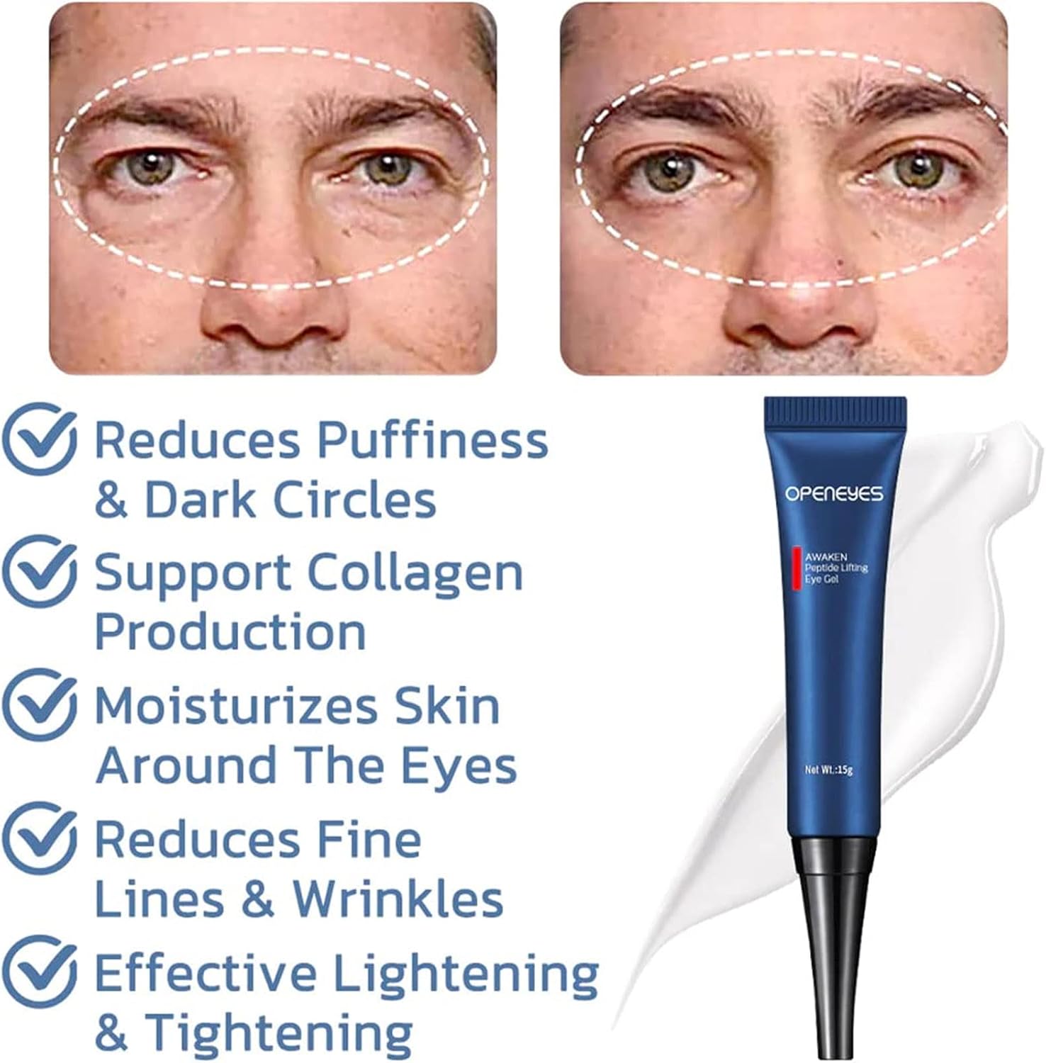 1+1 GRATIS | OpenEyes™ - Revitalisierendes Augen-Lifting-Gel für Männer und Frauen