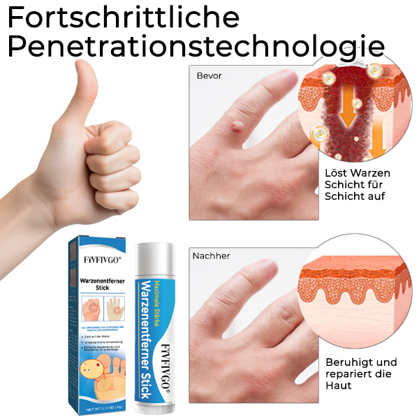 1+1 GRATIS | DermaCare™ Schnelle Warzenentfernung