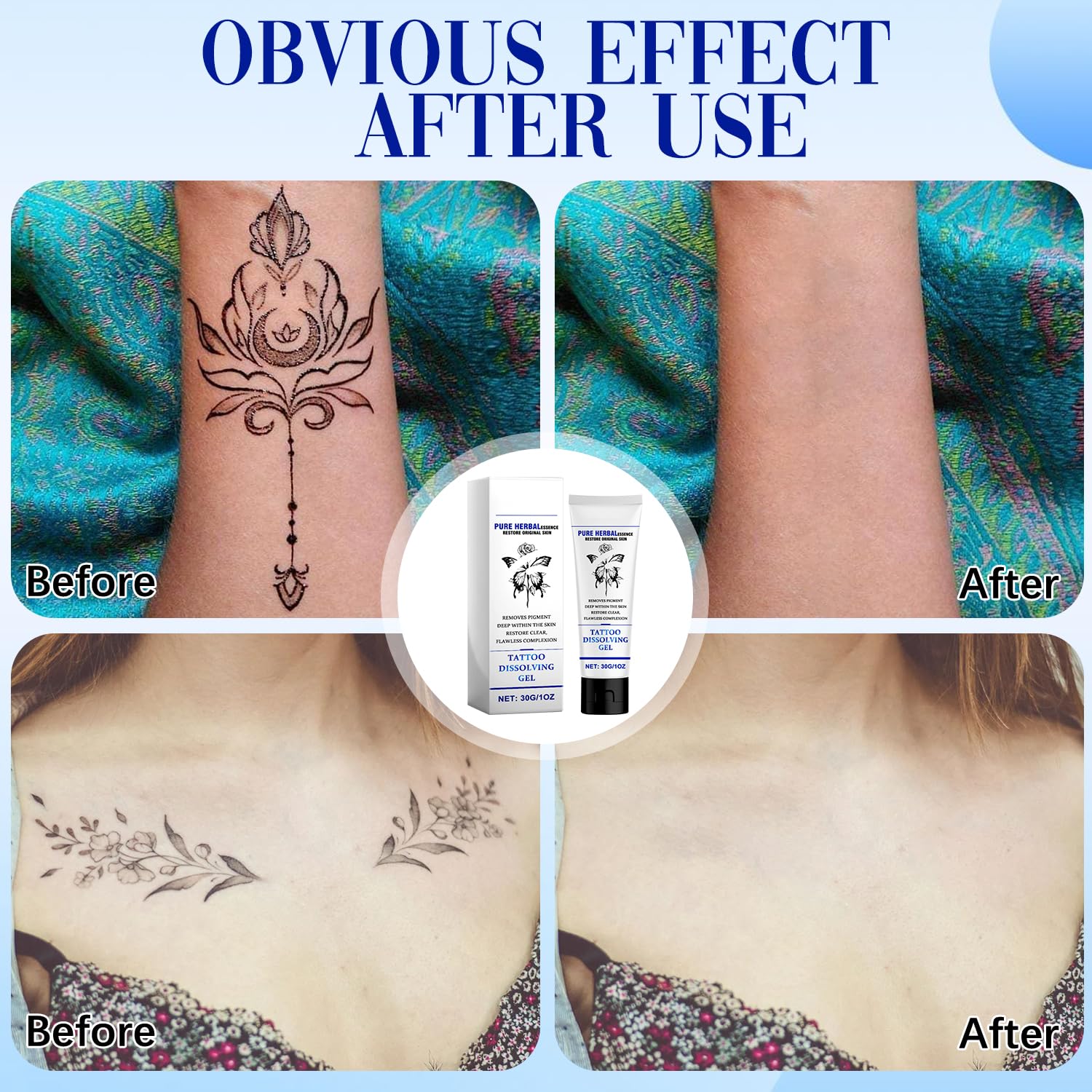 1+1 GRATIS | FadeAway™ - Mühelose Tattoo-Entfernung für eine saubere Weste!