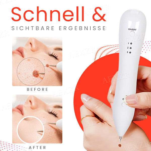 1+1 GRATIS | LuminSkin™ Verabschieden Sie sich von Hautunreinheiten