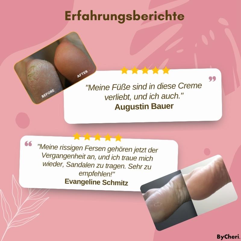 1+1 GRATIS | SoleRejuve™ Sofortige Fußpflege
