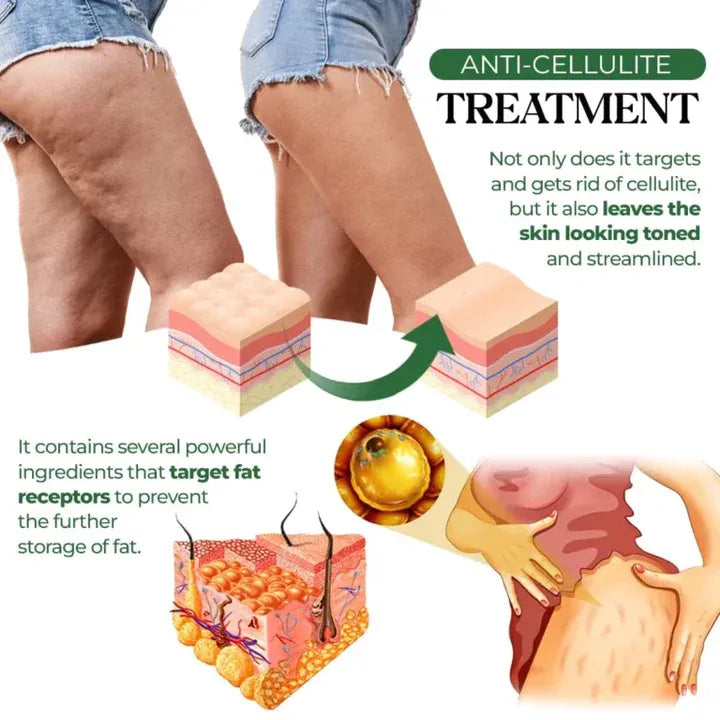 1+1 GRATIS | HerbalFusion™ Cellulite-Zielpflaster