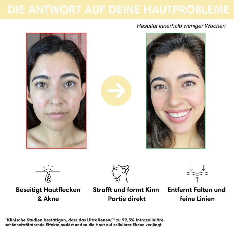 UltraRenew™ - Jugendliches Aussehen in nur 10 Minuten!