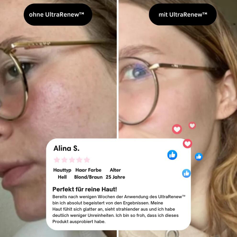 UltraRenew™ - Jugendliches Aussehen in nur 10 Minuten!