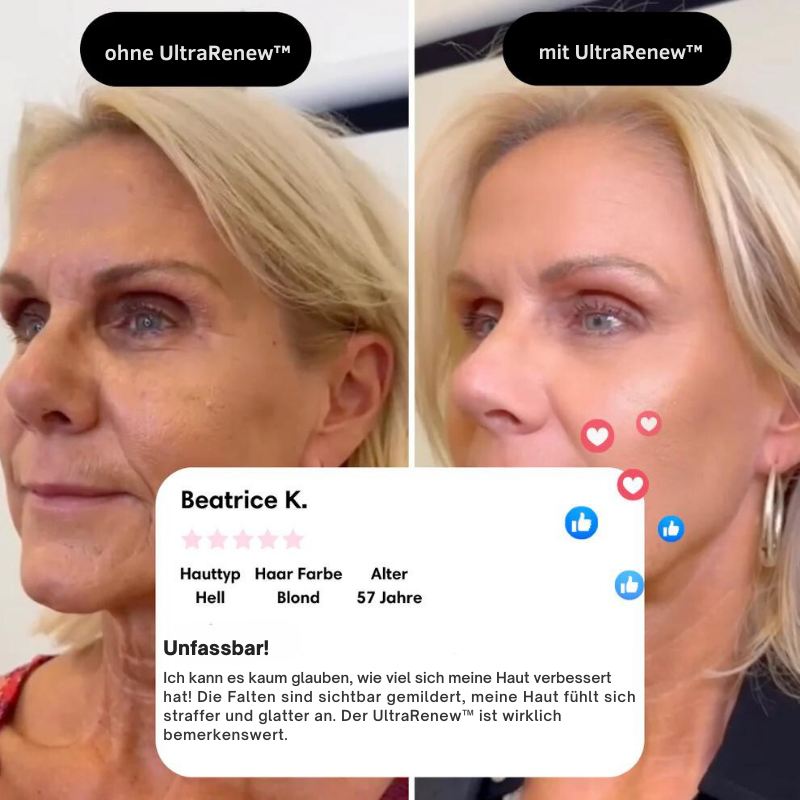 UltraRenew™ - Jugendliches Aussehen in nur 10 Minuten!