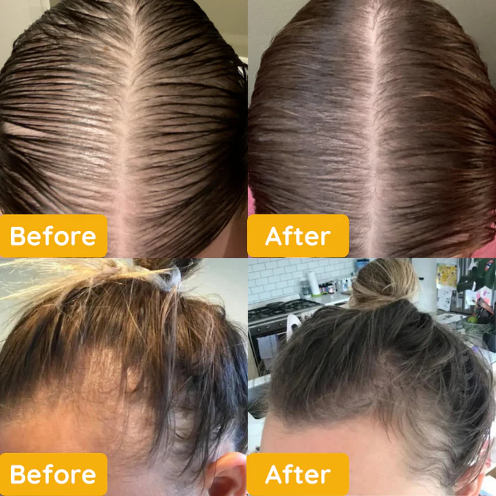 1+1 Gratis | Jairy™ - Ätherisches Öl für das Haarwachstum