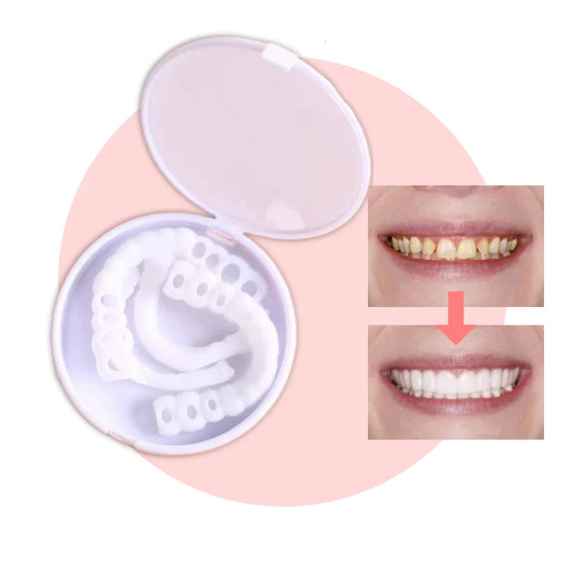 SmileEZ™ – Sofortige Lächeln-Transformation