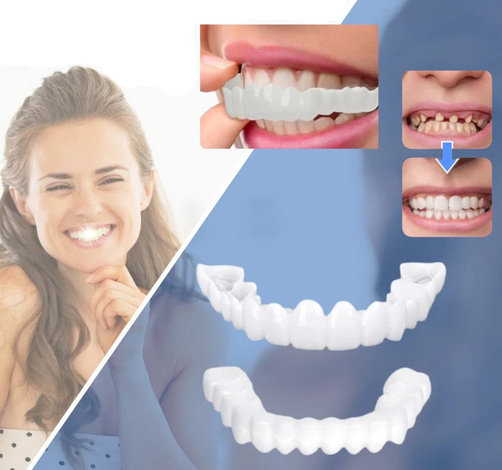 SmileEZ™ – Sofortige Lächeln-Transformation