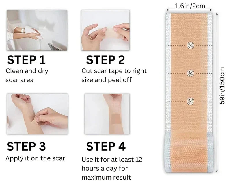 1+1 GRATIS | ScarGlow™ Lässt hartnäckige Narben verblassen