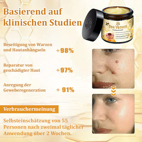 1+1 GRATIS | Turonu™ - Bienengift-Multitherapie-Creme