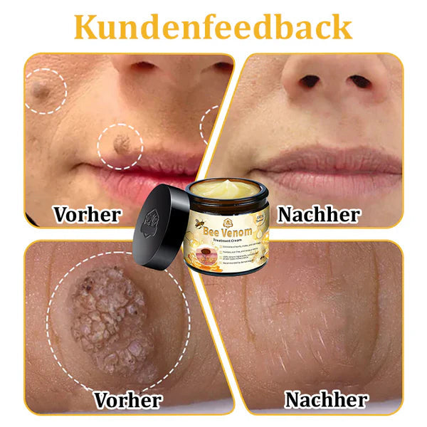 1+1 GRATIS | Turonu™ - Bienengift-Multitherapie-Creme