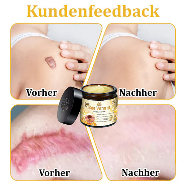 1+1 GRATIS | Turonu™ - Bienengift-Multitherapie-Creme